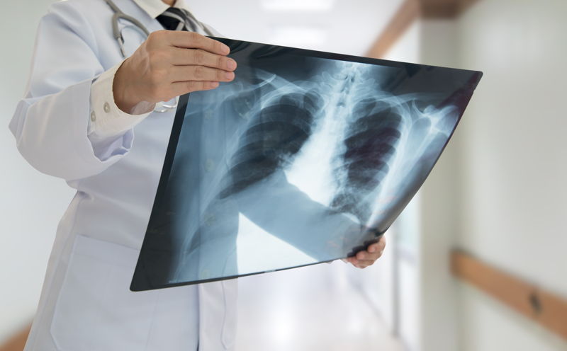 radiografia de torax